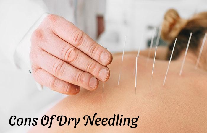 the Pros And Cons Of Dry Needling - Cons Of Dry Needling