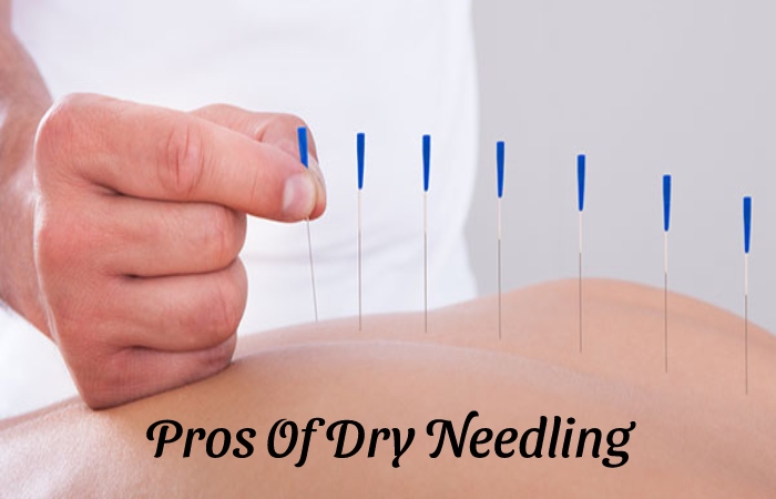 the Pros And Cons Of Dry Needling - Pros Of Dry Needling