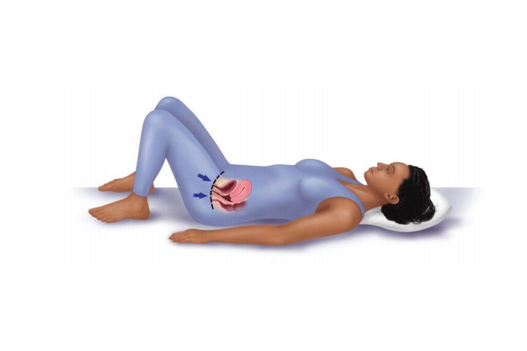 Pelvic Floor Exercises