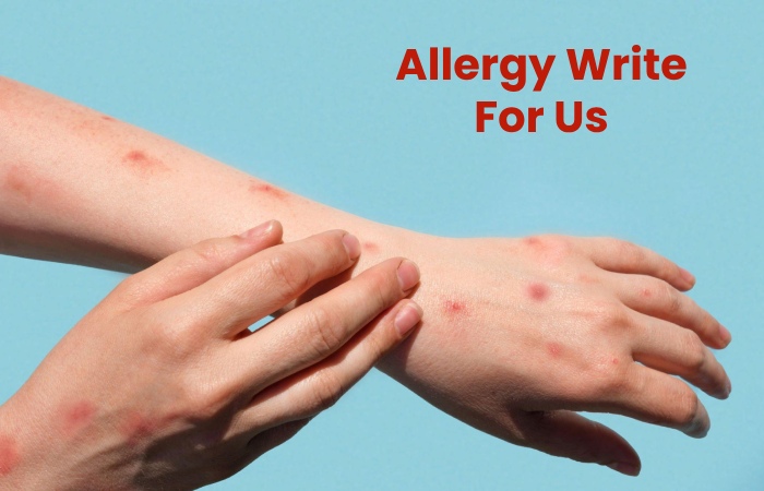 Allergy Write For Us