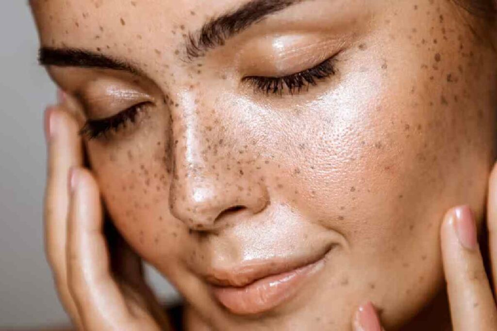 5 Easy Home Remedies For Glowing Skin