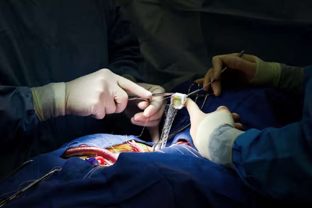 How to Choose a Heart Surgeon?