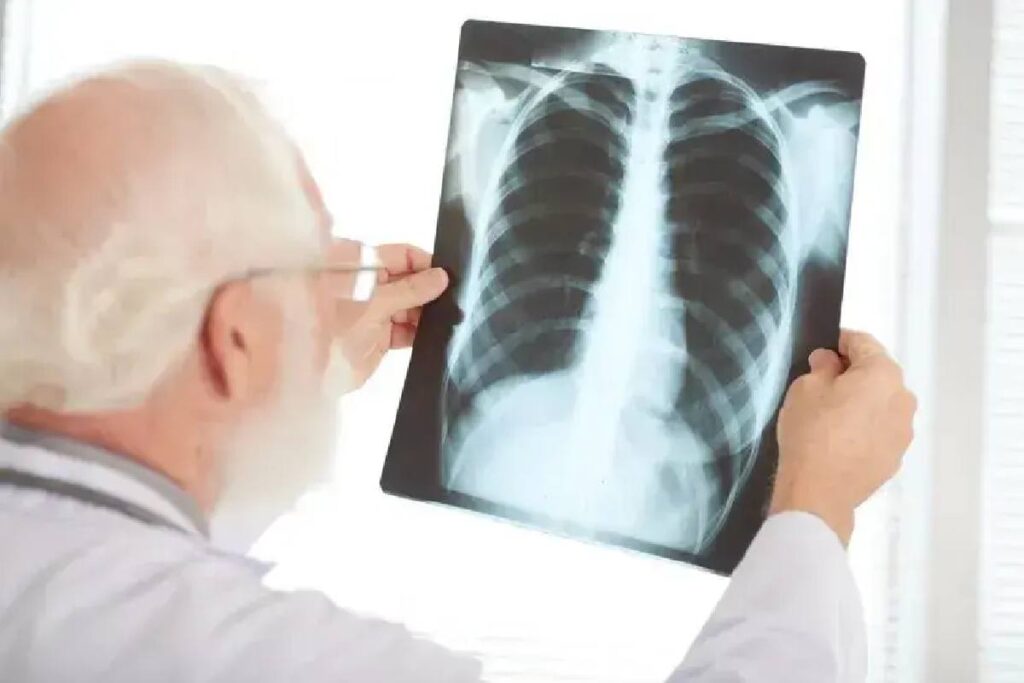 when Is Pneumonia Contagious