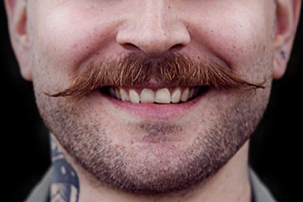There Are A Few Myths About Beard Transplantation.