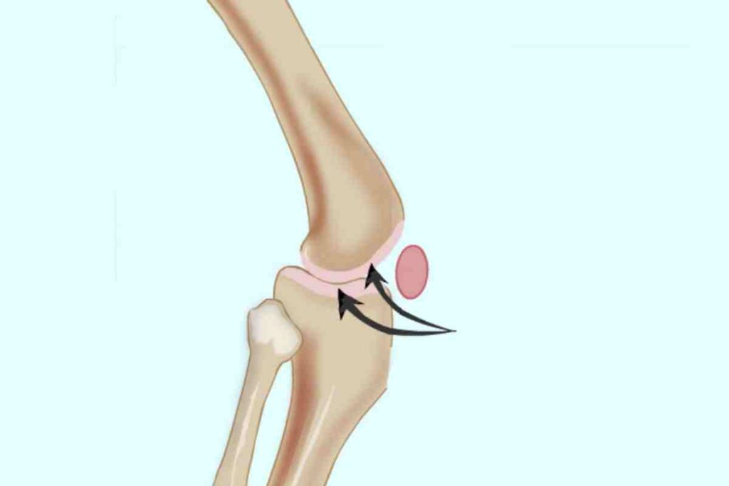 Improve Your Joint Cartilage Flexibility with Cartiflex® Joint Cartilage Flexibility with Cartiflex